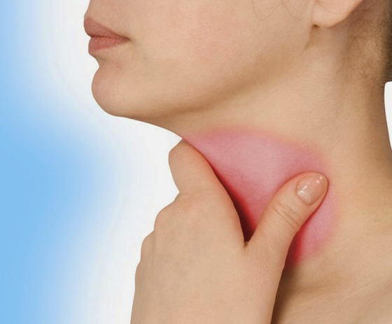 علاج التهاب الحلق في 10 خطوات رائعة وبسيطة صورة رقم 4