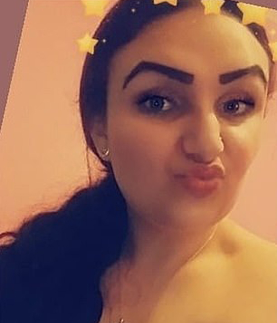 صبغة شعر تتسبب بتضخم وجه مراهقة وتصيبها بالعمى لمدة يومين! صور صورة رقم 7 صبغة شعر تتسبب بتضخم وجه مراهقة وتصيبها بالعمى لمدة يومين! صور صورة رقم 7