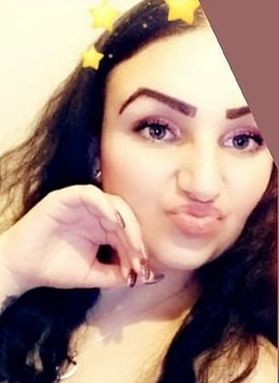 صبغة شعر تتسبب بتضخم وجه مراهقة وتصيبها بالعمى لمدة يومين! صور صورة رقم 9 صبغة شعر تتسبب بتضخم وجه مراهقة وتصيبها بالعمى لمدة يومين! صور صورة رقم 9