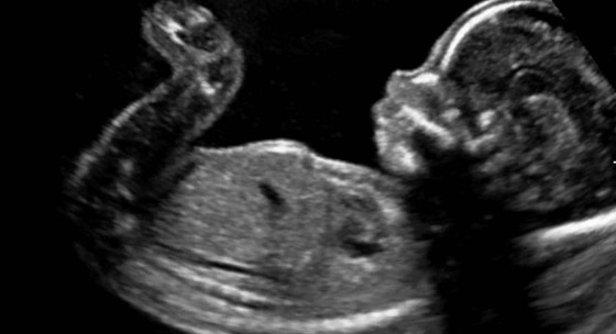 5 أمور غريبة يقوم بها كل جنين في رحم أمه صورة رقم 3