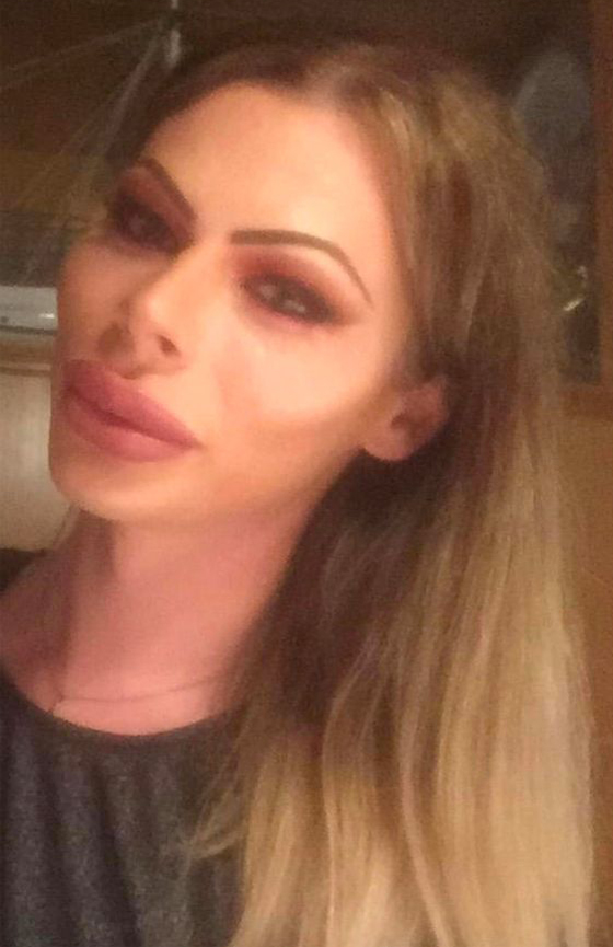 بالصور: أنفق الآف الدولارات ليصبح باربي.. هكذا أصبح شكله الجديد  صورة رقم 12