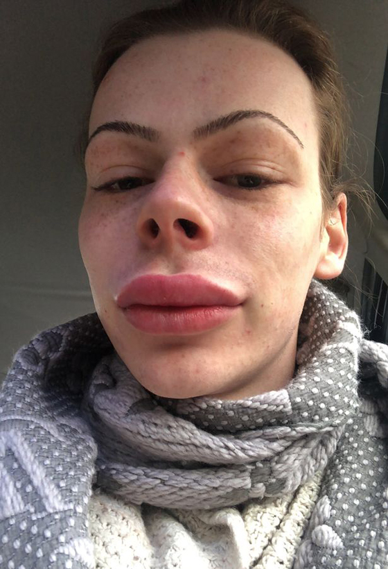 بالصور: أنفق الآف الدولارات ليصبح باربي.. هكذا أصبح شكله الجديد  صورة رقم 13