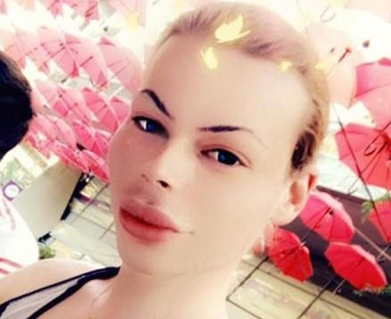 بالصور: أنفق الآف الدولارات ليصبح باربي.. هكذا أصبح شكله الجديد  صورة رقم 15