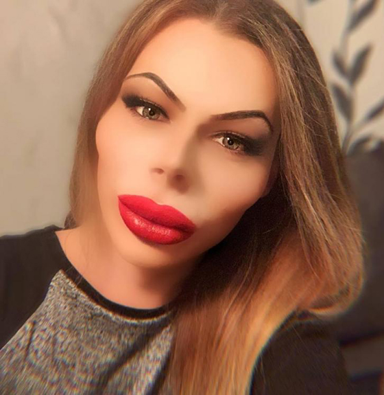 بالصور: أنفق الآف الدولارات ليصبح باربي.. هكذا أصبح شكله الجديد  صورة رقم 16