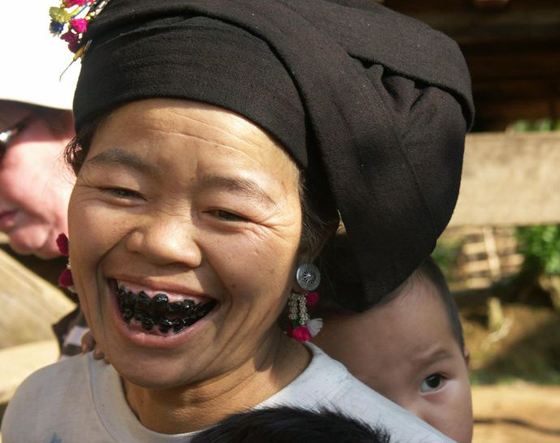 تسويد الأسنان والاستحمام بالبراز: أغرب أشياء قامت بها الفتيات لاكتساب الجمال!  صورة رقم 1