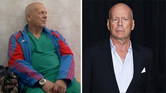  شبه غريب بين النجوم وأشباههم (2): بالصور صورة رقم 5