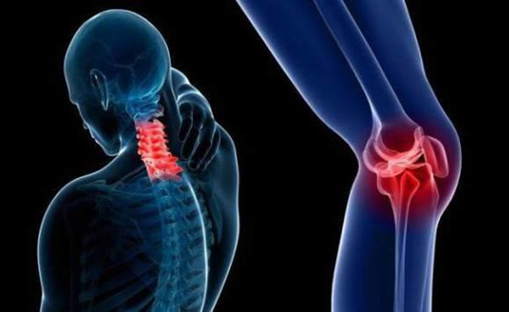نصائح طبية.. هكذا تحمي عظامك مع تقدمك في العمر صورة رقم 6