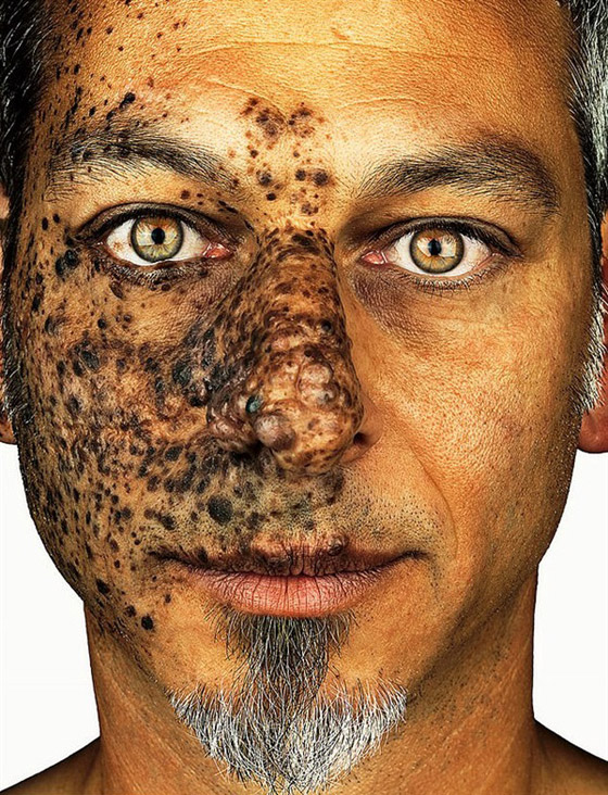 صور وحمات غريبة لأشخاص في جلسة تصوير لتقبل الذات صورة رقم 7