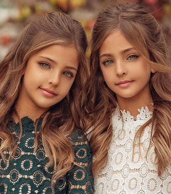 صور أجمل توأم في العالم، وانتقاد والدتهما بسبب إفساد طفولتهما صورة رقم 25 صور أجمل توأم في العالم، وانتقاد والدتهما بسبب إفساد طفولتهما صورة رقم 25