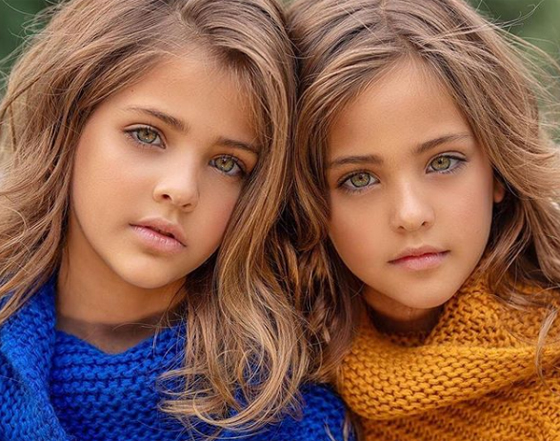 صور أجمل توأم في العالم، وانتقاد والدتهما بسبب إفساد طفولتهما صورة رقم 27 صور أجمل توأم في العالم، وانتقاد والدتهما بسبب إفساد طفولتهما صورة رقم 27
