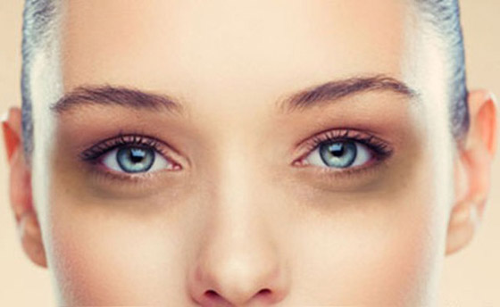 5 معتقدات شائعة حول الهالات الداكنة صورة رقم 6