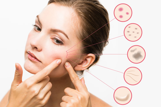احذري.. مستحضرات التجميل تهدد البشرة بهذا المرض صورة رقم 2