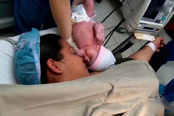 ظاهرة غريبة نادرة الحدوث: امرأة كولومبية تنجب طفلة حامل (بالصور) صورة رقم 3