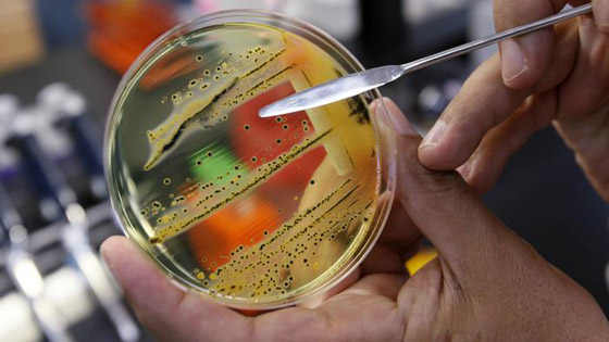 تعرفوا إلى أخطر الجراثيم والبكتيريا القاتلة والمقاومة للأدوية في العالم صورة رقم 4 تعرفوا إلى أخطر الجراثيم والبكتيريا القاتلة والمقاومة للأدوية في العالم صورة رقم 4