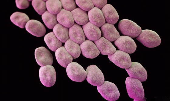 تعرفوا إلى أخطر الجراثيم والبكتيريا القاتلة والمقاومة للأدوية في العالم صورة رقم 5 تعرفوا إلى أخطر الجراثيم والبكتيريا القاتلة والمقاومة للأدوية في العالم صورة رقم 5