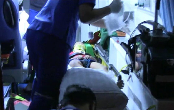 فتاة تعاني من المشي أثناء النوم تنجو بأعجوبة بعد سقوطها من شرفة بالطابق الـ11 صورة رقم 5