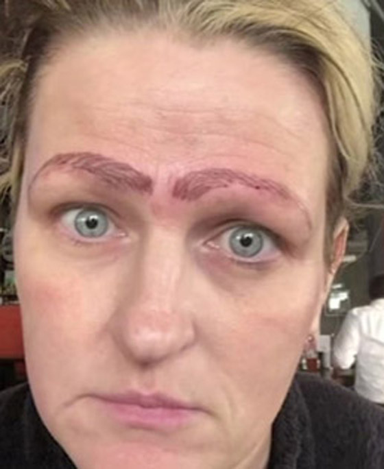 صور صادمة: سيدة خضعت لعملية تجميل لحاجبيها، فخرجت بأربعة حواجب صورة رقم 5