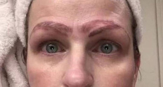 صور صادمة: سيدة خضعت لعملية تجميل لحاجبيها، فخرجت بأربعة حواجب صورة رقم 4
