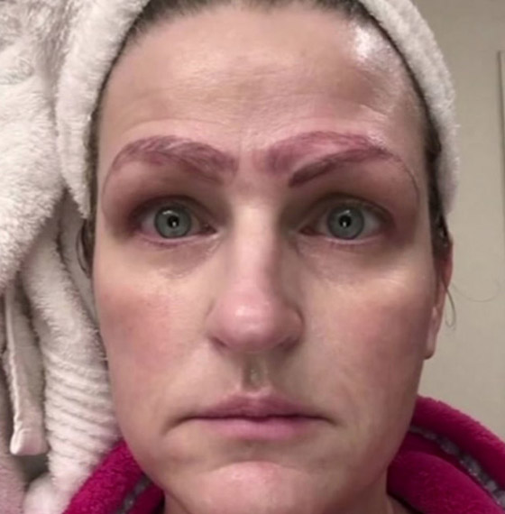 صور صادمة: سيدة خضعت لعملية تجميل لحاجبيها، فخرجت بأربعة حواجب صورة رقم 1