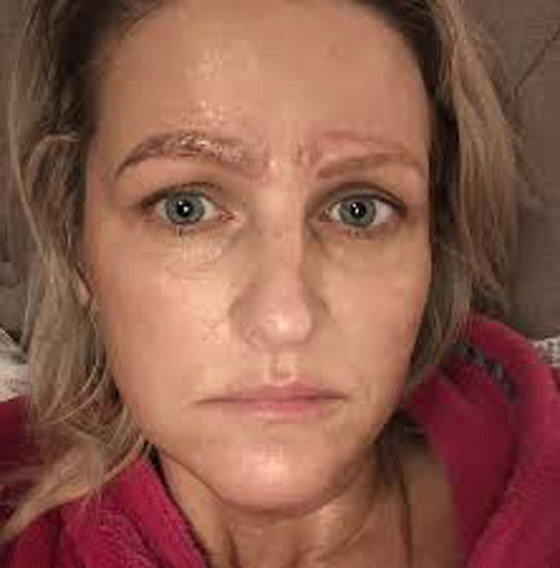 صور صادمة: سيدة خضعت لعملية تجميل لحاجبيها، فخرجت بأربعة حواجب صورة رقم 3