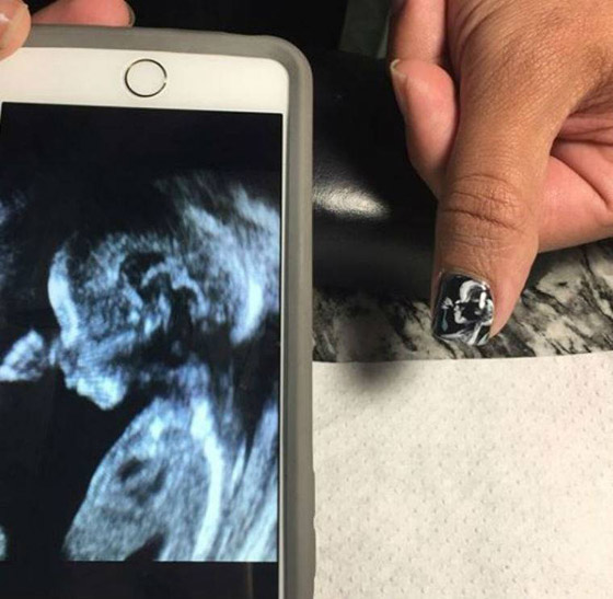 صورة الجنين.. آخر صيحات الموضة للطباعة على الأظافر صورة رقم 2