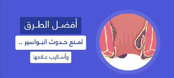 كيف تحصل البواسير وكيفية علاجها؟! صورة رقم 1