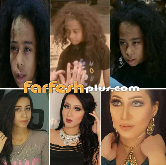 صورة رقم 3 - نجوم اختفوا عن الأنظار منذ سنوات.. كيف أصبح شكلهم الآن؟ صورة رقم 3 - نجوم اختفوا عن الأنظار منذ سنوات.. كيف أصبح شكلهم الآن؟