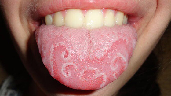 إليكم 10 من أغرب الحالات الطبية والاضطرابات العقلية والجسدية النادرة صورة رقم 7 إليكم 10 من أغرب الحالات الطبية والاضطرابات العقلية والجسدية النادرة صورة رقم 7