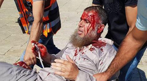 قوات الاحتلال تقتحم المسجد الأقصى وتهاجم المصلين بعد صلاة العيد صورة رقم 20 قوات الاحتلال تقتحم المسجد الأقصى وتهاجم المصلين بعد صلاة العيد صورة رقم 20