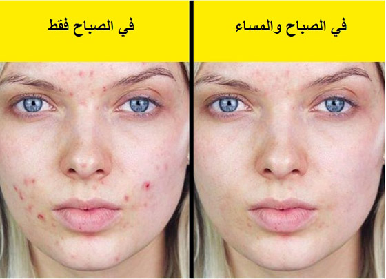 8 منتجات تجميل نستخدمها بشكل خاطئ صورة رقم 6
