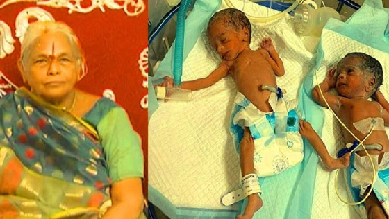 مُسنة هندية تلد طفلة وزنها 600 غرام فقط لتصبح أكبر أم تُنجب في العالم صورة رقم 3 مُسنة هندية تلد طفلة وزنها 600 غرام فقط لتصبح أكبر أم تُنجب في العالم صورة رقم 3