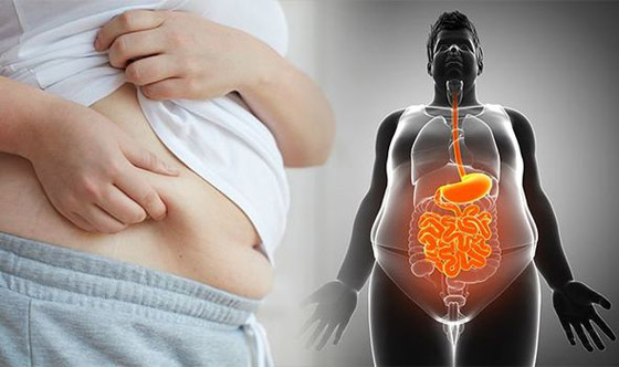 3 عادات سيئة تؤدي إلى السمنة وزيادة الوزن! فاحذروها..! صورة رقم 7