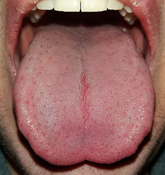 إليكم 20 نظرية علمية مجنونة كان البشر يصدقونها قديما صورة رقم 9