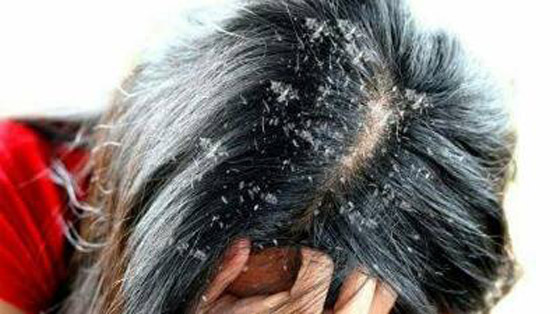 4 استخدامات جمالية للملح لا يعرفها كثيرون صورة رقم 1