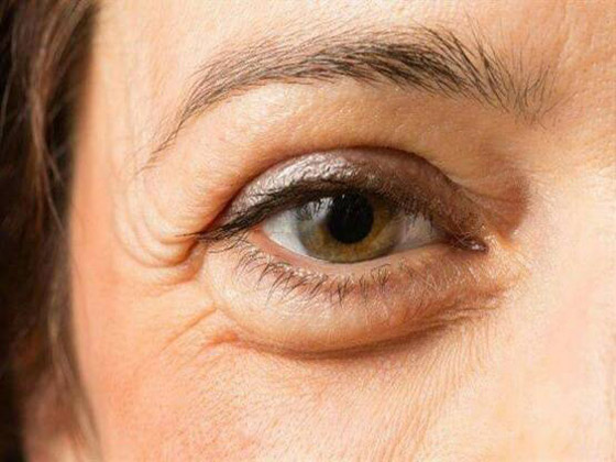 4 استخدامات جمالية للملح لا يعرفها كثيرون صورة رقم 2