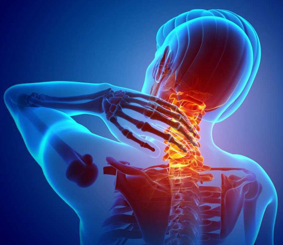 إذا تزامنت مع عوارض أخرى فهي إنذار خطر.. إليكم أسباب آلام الرقبة صورة رقم 8