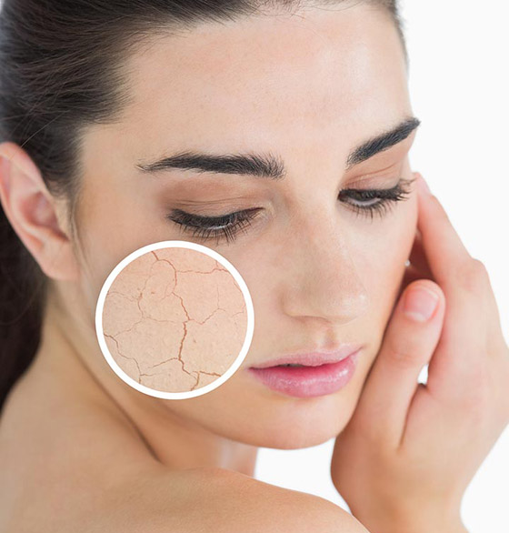 إليكم 7 علامات تدل على الشيخوخة المبكرة وطرق مكافحة كل منها! صورة رقم 2 إليكم 7 علامات تدل على الشيخوخة المبكرة وطرق مكافحة كل منها! صورة رقم 2