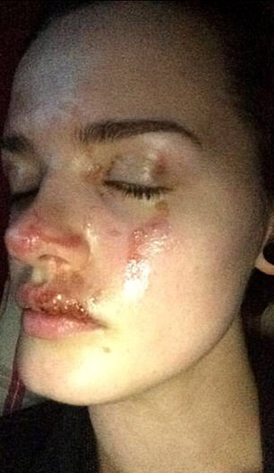أرادت سهرة رومانسية مع حبيبها فوقعت كارثة لم تكن بالحسبان! صورة رقم 8 أرادت سهرة رومانسية مع حبيبها فوقعت كارثة لم تكن بالحسبان! صورة رقم 8