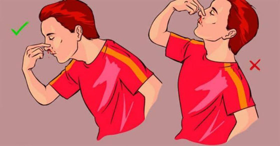 نزيف الأنف المفاجئ.. ما هي أسبابه وطريقة علاجه؟ صورة رقم 3