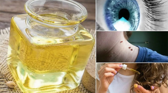 تعرفوا إلى الفوائد الطبية لزيت الخروع وأهم مشاكل الشعر التي يعالجها صورة رقم 9