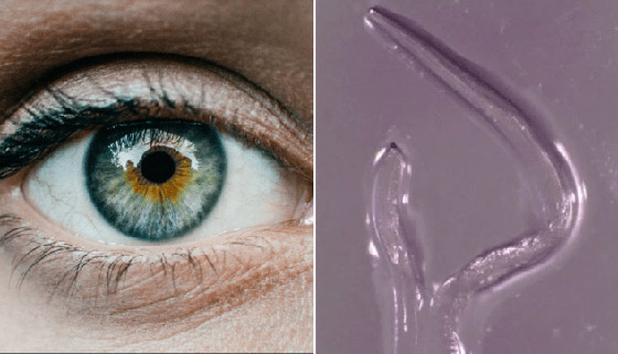 ظاهرة مخيفة.. امرأة تكتشف ديدان طفيلية في عينها وتخرجهم بنفسها! صورة رقم 4 ظاهرة مخيفة.. امرأة تكتشف ديدان طفيلية في عينها وتخرجهم بنفسها! صورة رقم 4