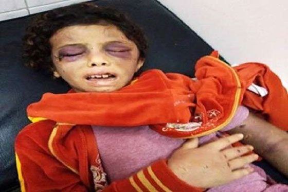 هذا ما فعلته خالة بابنة أختها في مصر صورة رقم 2 هذا ما فعلته خالة بابنة أختها في مصر صورة رقم 2