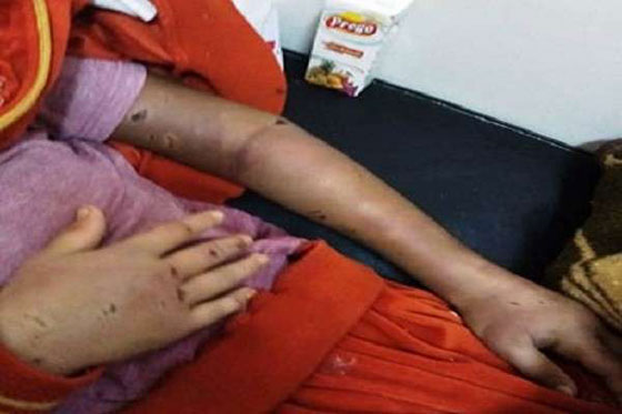 هذا ما فعلته خالة بابنة أختها في مصر صورة رقم 6 هذا ما فعلته خالة بابنة أختها في مصر صورة رقم 6