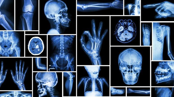 إليكم أبرز الاختراعات التي وُجدت عن طريق الصدفة وغيرت وجه العالم صورة رقم 6 إليكم أبرز الاختراعات التي وُجدت عن طريق الصدفة وغيرت وجه العالم صورة رقم 6