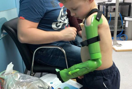 صبي في الخامسة يعانق أخاه للمرة الأولى صورة رقم 7