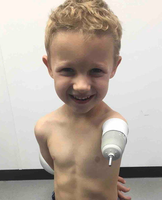 صبي في الخامسة يعانق أخاه للمرة الأولى صورة رقم 21