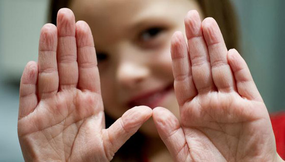 ما سبب تجعد الأصابع وانكماشها عند تعرضها للماء؟ صورة رقم 3