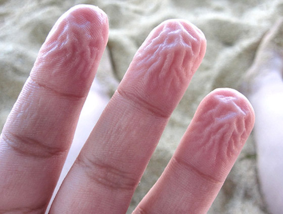 ما سبب تجعد الأصابع وانكماشها عند تعرضها للماء؟ صورة رقم 2