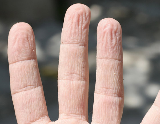 ما سبب تجعد الأصابع وانكماشها عند تعرضها للماء؟ صورة رقم 4