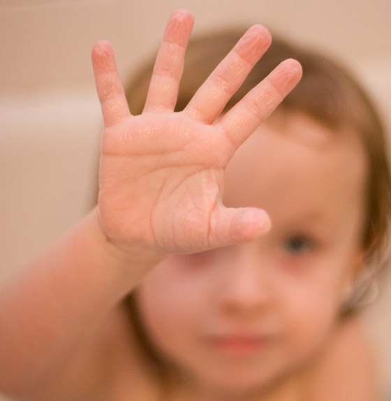 ما سبب تجعد الأصابع وانكماشها عند تعرضها للماء؟ صورة رقم 5